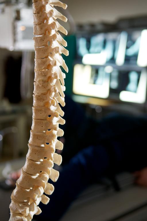 Image of Spine